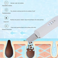 Yrelora™ Ultrasonic Skin Scrubber | Clearer-Looking Skin Without Squeezing, Picking, or Pain